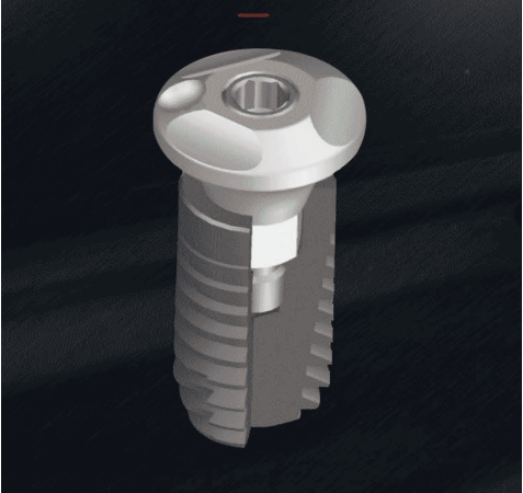 Antdental 安特 多功能种植扫描体 适配登腾种植系统（带牙龈愈合功能和传统转移杆功能的扫描杆） R 4.0*2.5